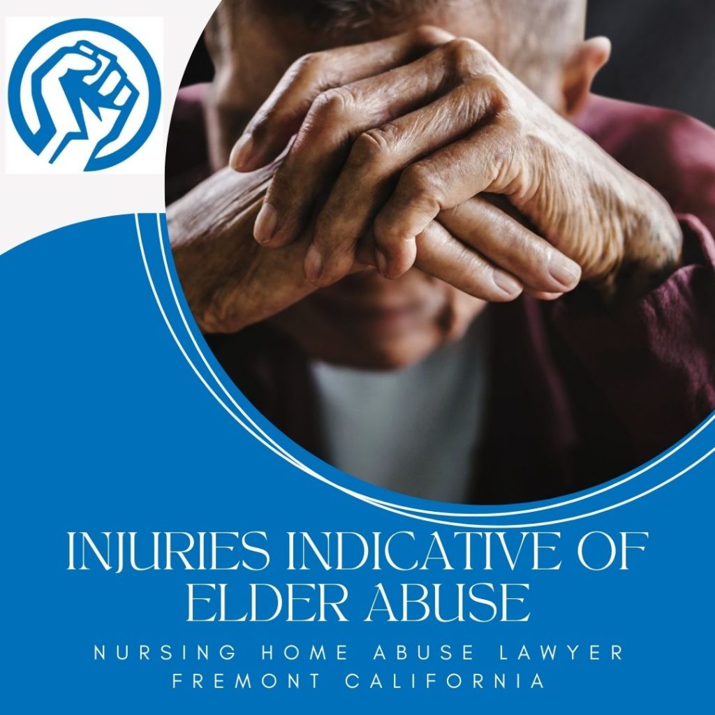 Nursing Home Abuse Lawyer Fremont California | Siegal and Richardson